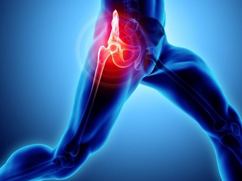 انواع بیماری پوبالژیا