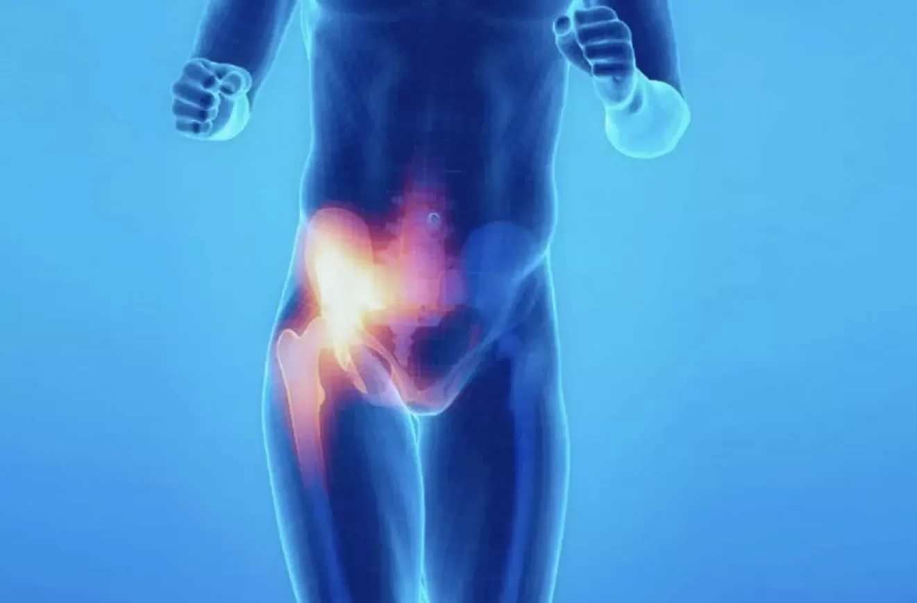 درمان پوبالژیا